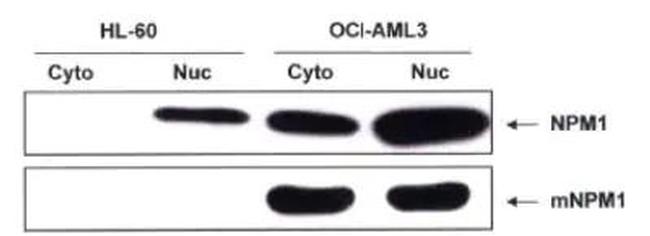 NPM1 (mutant) Antibody in Western Blot (WB)