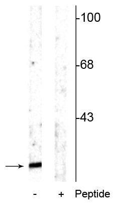 Phospho-alpha Synuclein (Ser129) Antibody in Western Blot (WB)