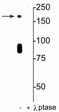 Phospho-NMDAR2B (Ser1480) Antibody in Western Blot (WB)