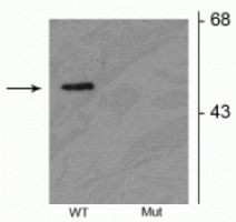 Phospho-Parkin (Ser378) Antibody in Western Blot (WB)