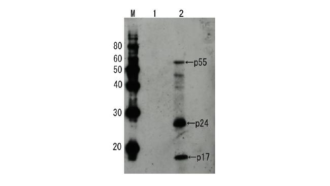 HIV1 p55 Antibody in Western Blot (WB)