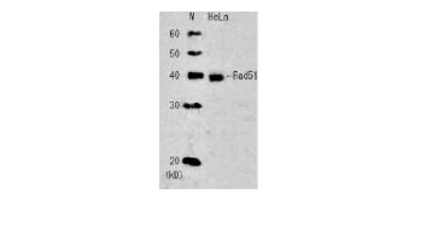 RAD51 Antibody in Western Blot (WB)