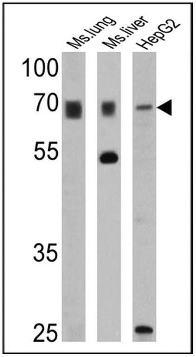 PMP70 Antibody in Western Blot (WB)
