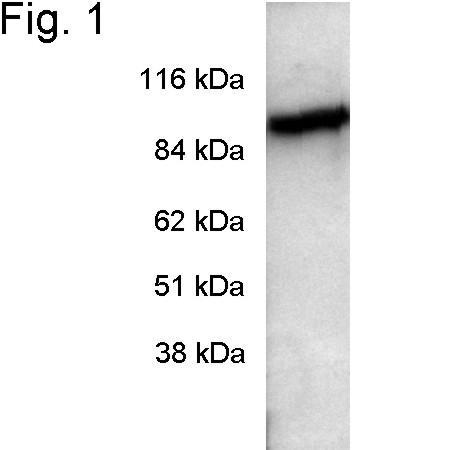PDE6A Antibody in Western Blot (WB)