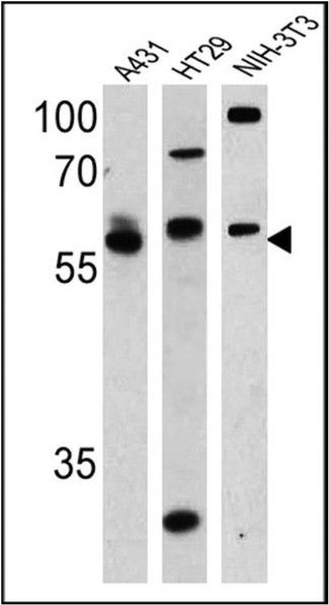 Cannabinoid Receptor 1 Antibody in Western Blot (WB)