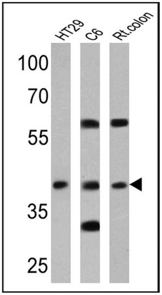 CNR2 Antibody in Western Blot (WB)