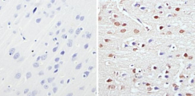 MECP2 Antibody in Immunohistochemistry (Paraffin) (IHC (P))