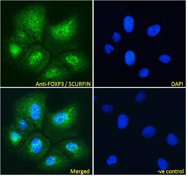 FOXP3 Antibody in Immunocytochemistry (ICC/IF)