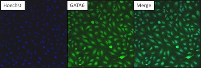 GATA6 Antibody in Immunocytochemistry (ICC/IF)