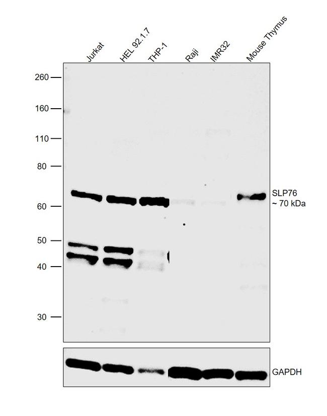 SLP76 Antibody in Western Blot (WB)