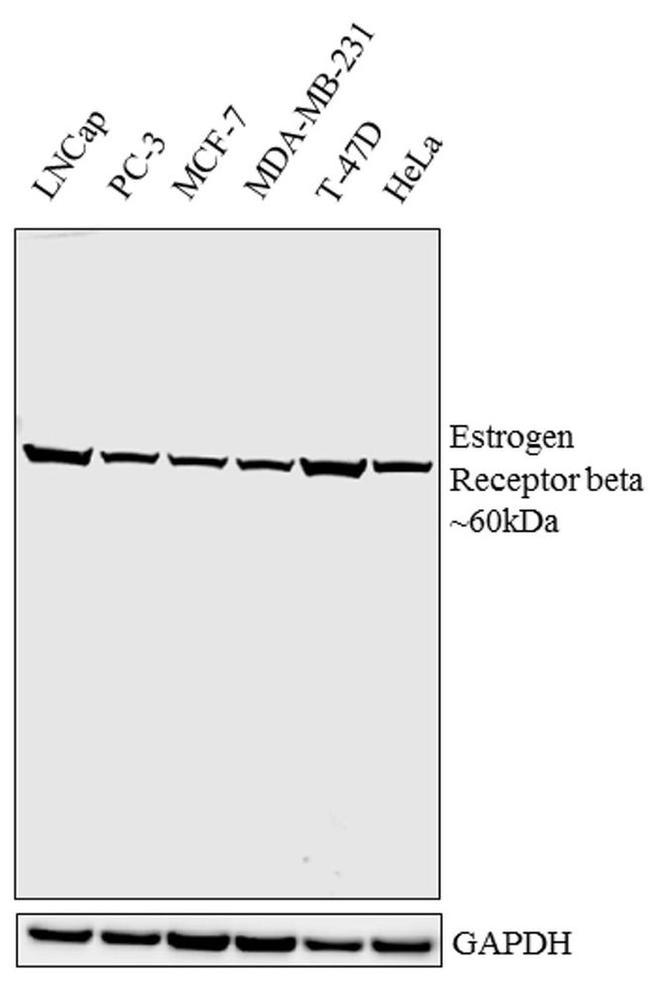 Estrogen Receptor beta Antibody in Western Blot (WB)