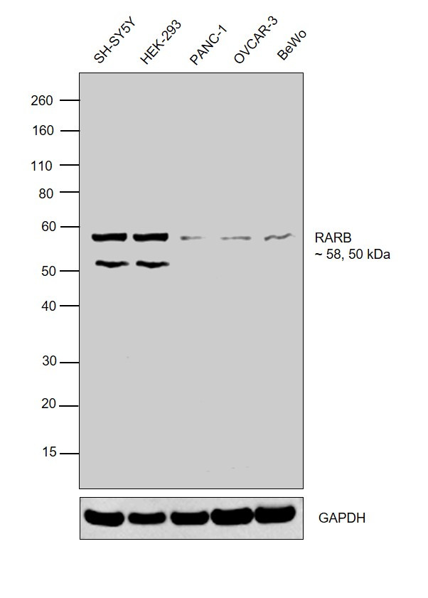 RARB Antibody