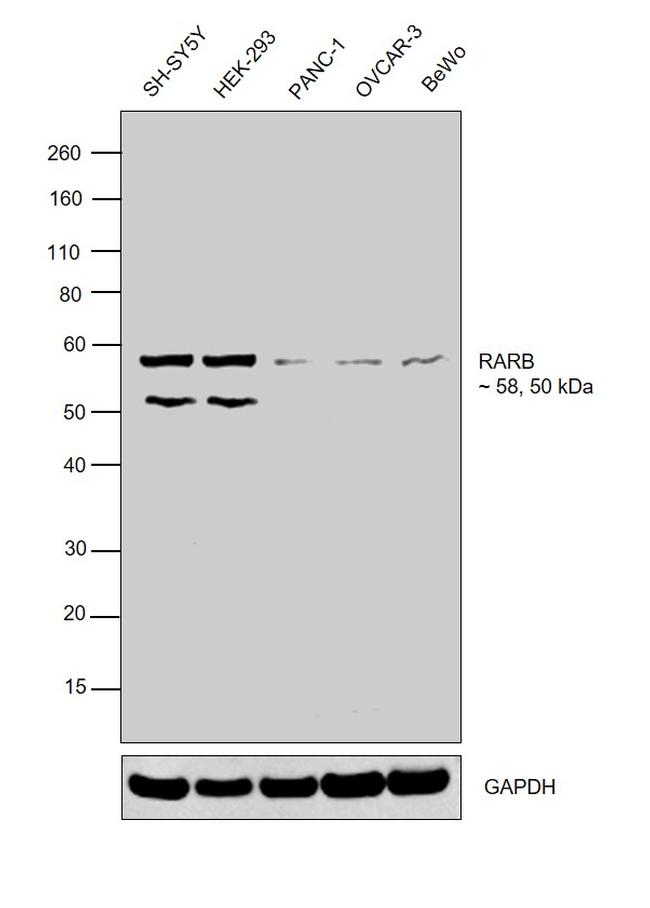 RARB Antibody in Western Blot (WB)