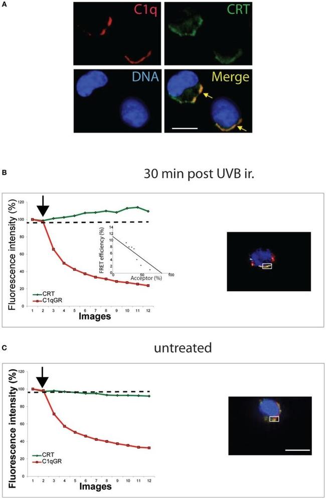 Calreticulin Antibody in Immunocytochemistry, Fluorescence Resonance Energy Transfer (ICC/IF, FRET)