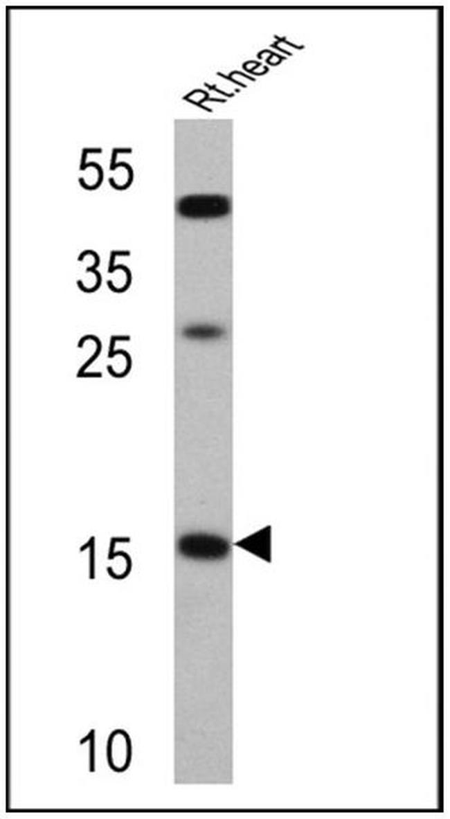 ANP Antibody in Western Blot (WB)
