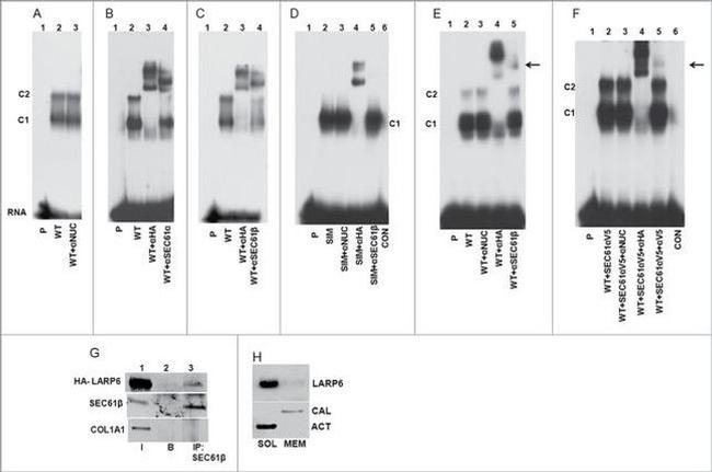 SEC61B Antibody in Western Blot, Immunoprecipitation (WB, IP)