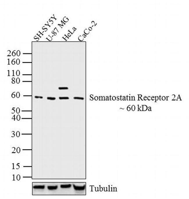 SSTR2 Antibody in Western Blot (WB)