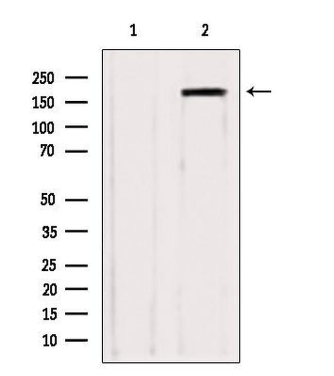 ZCCHC11 Antibody in Western Blot (WB)