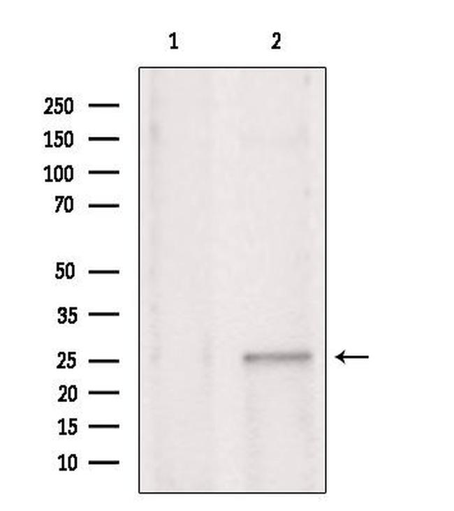 CHCHD6 Antibody in Western Blot (WB)