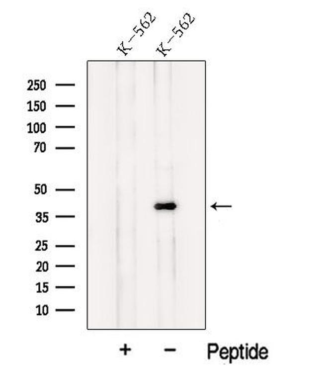 ILF2 Antibody in Western Blot (WB)