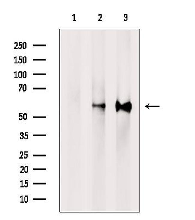 PPP3CB Antibody in Western Blot (WB)