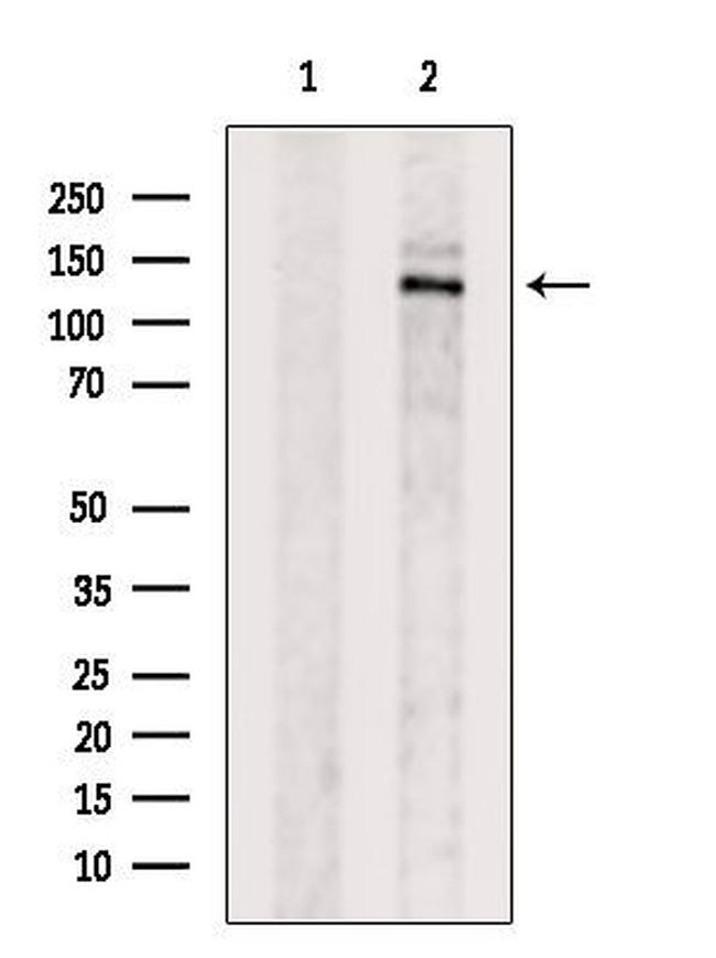 CYFIP2 Antibody in Western Blot (WB)
