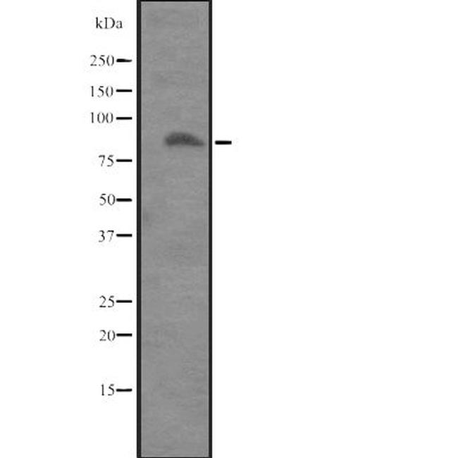 ITGB8 Antibody in Western Blot (WB)