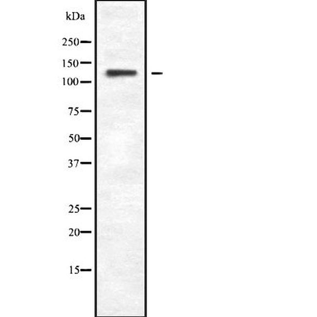 PLCB4 Antibody in Western Blot (WB)