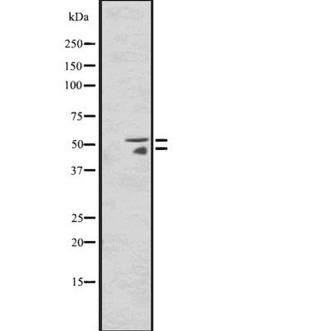 HNF4A/HNF4G Antibody in Western Blot (WB)