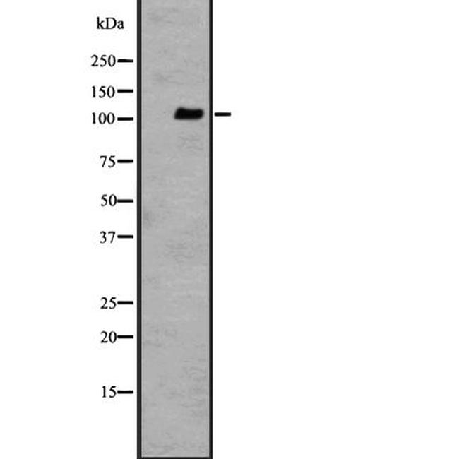 GPR110 Antibody in Western Blot (WB)