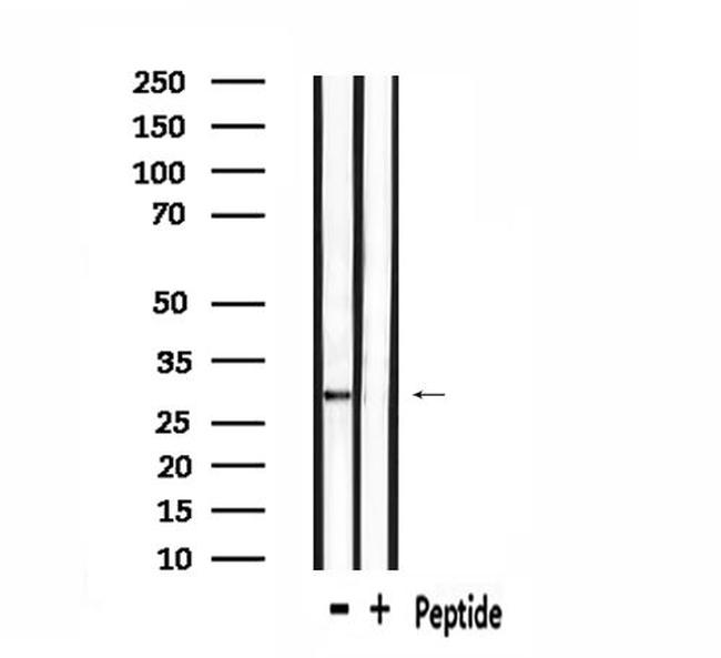 OR6C75 Antibody in Western Blot (WB)