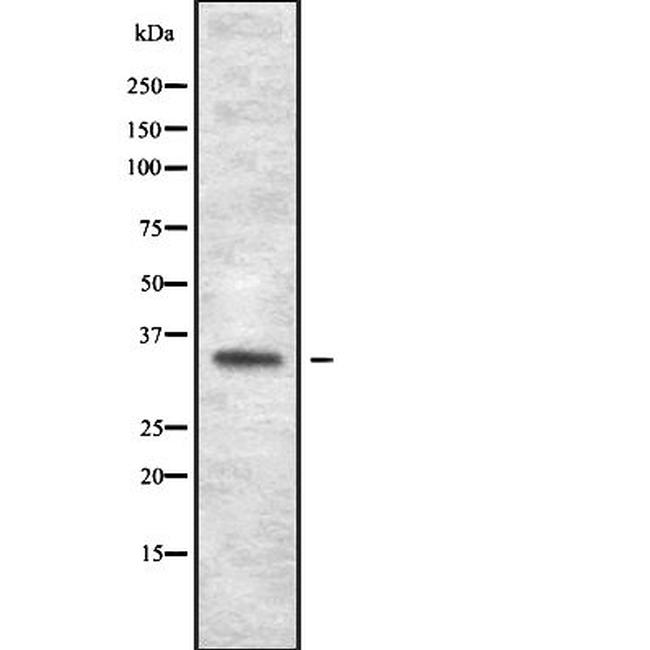 OR1J1 Antibody in Western Blot (WB)