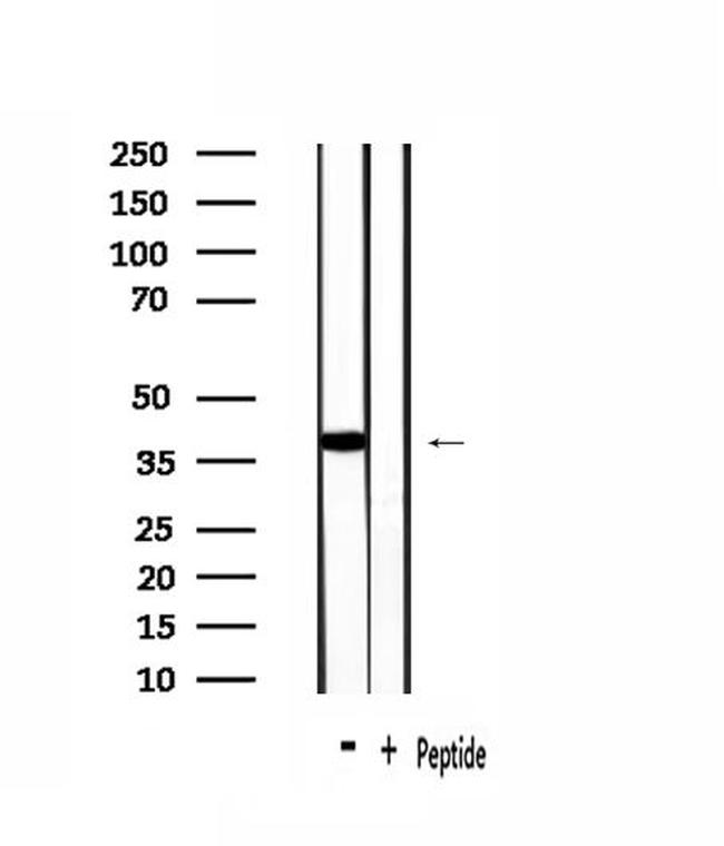 OR1J2/OR1N2 Antibody in Western Blot (WB)