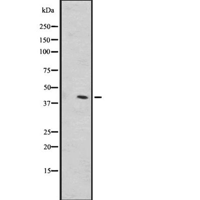 OR1L1 Antibody in Western Blot (WB)