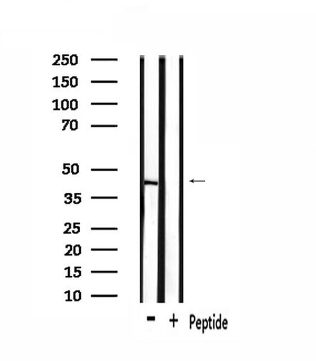 OR1L1 Antibody in Western Blot (WB)
