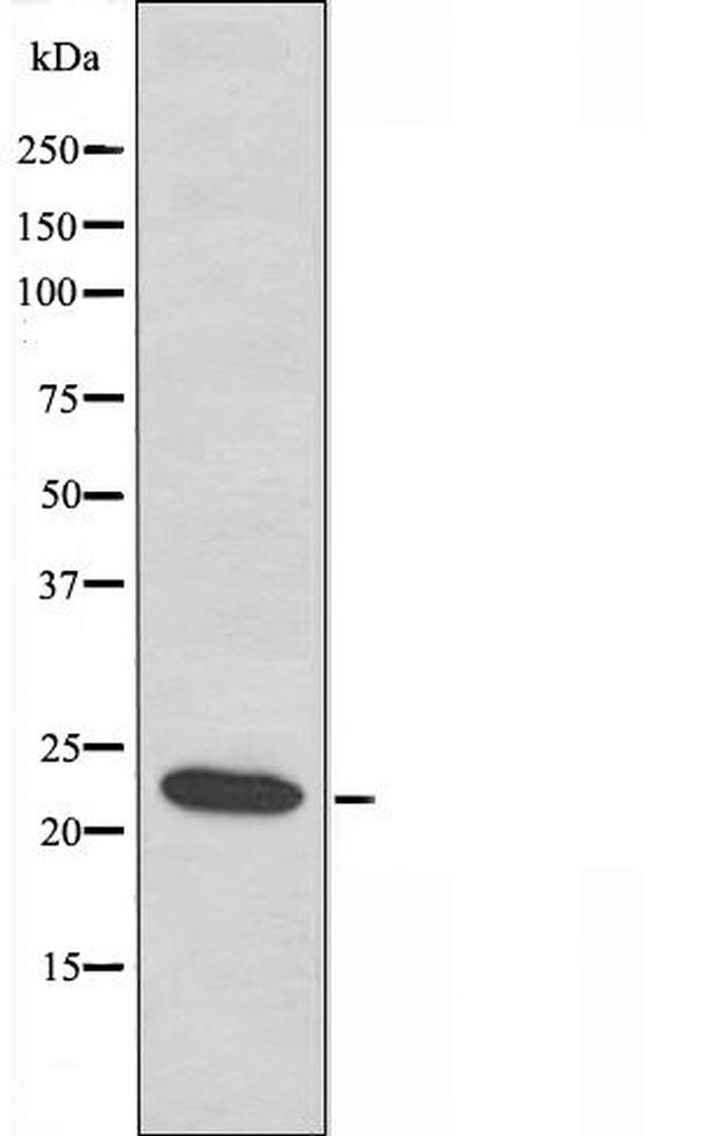 TPT1 Antibody in Western Blot (WB)