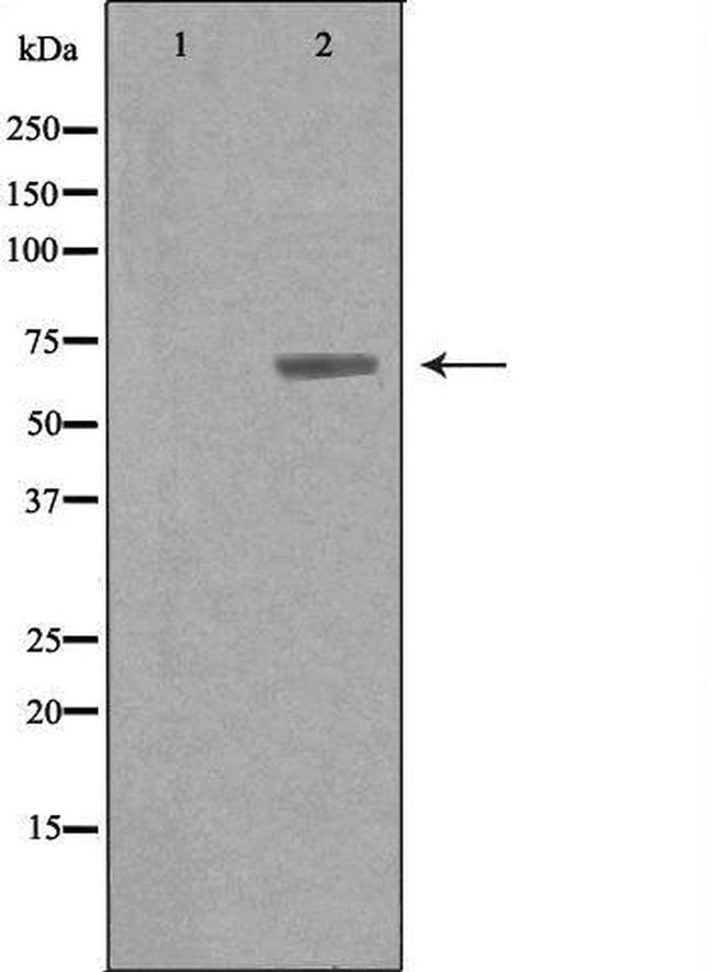 Arylsulfatase G Antibody in Western Blot (WB)