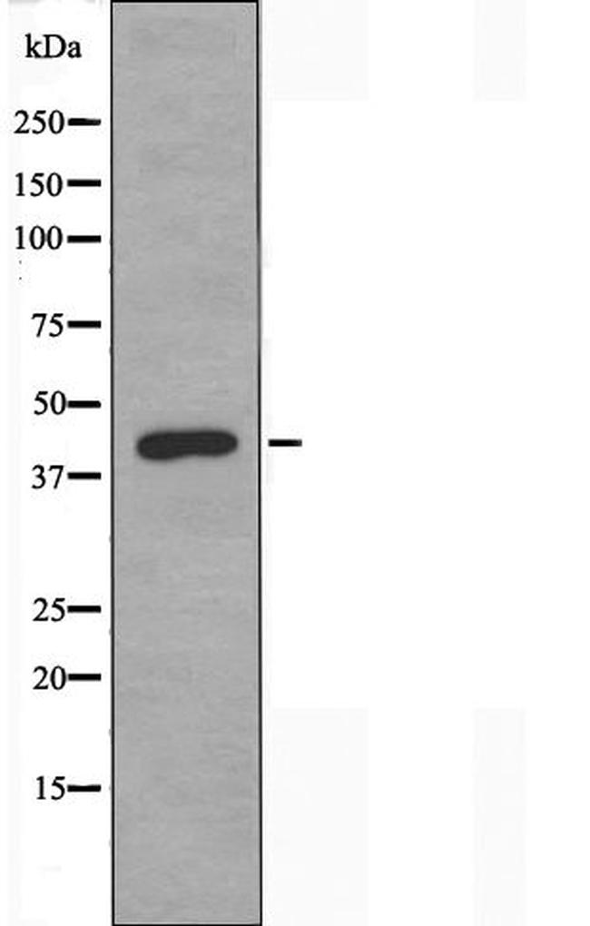 TBPL2 Antibody in Western Blot (WB)