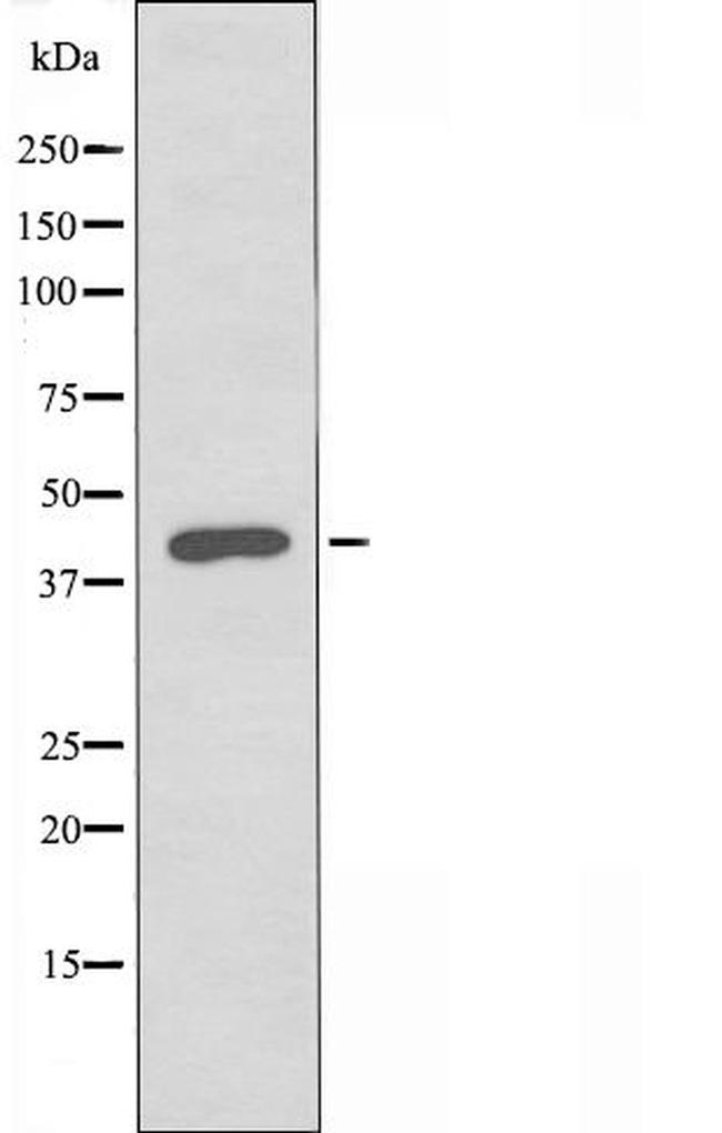 CD264 (TRAIL-R4) Antibody in Western Blot (WB)