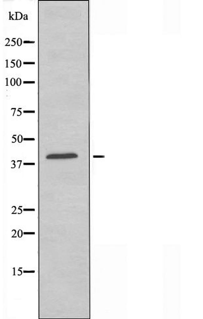 CCR11 Antibody in Western Blot (WB)