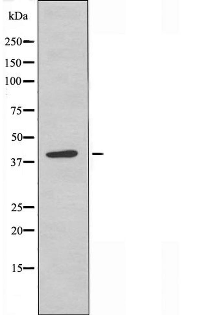 MCHR2 Antibody in Western Blot (WB)