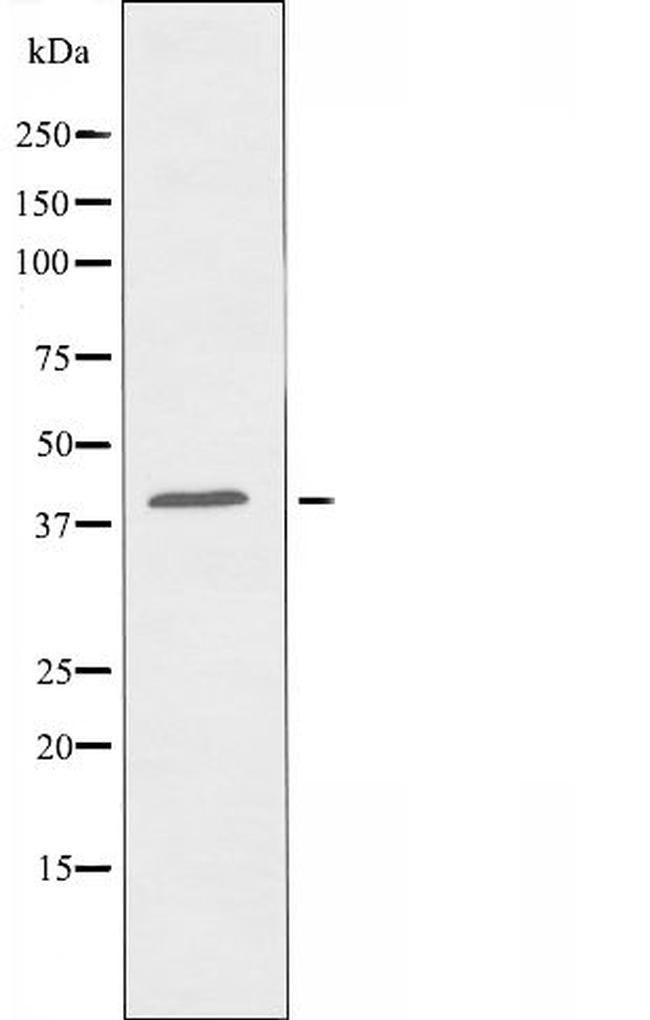 OR8S1 Antibody in Western Blot (WB)