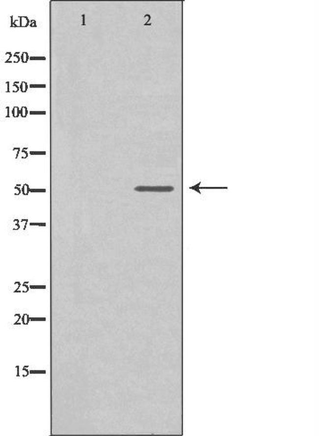 CD127 Antibody in Western Blot (WB)
