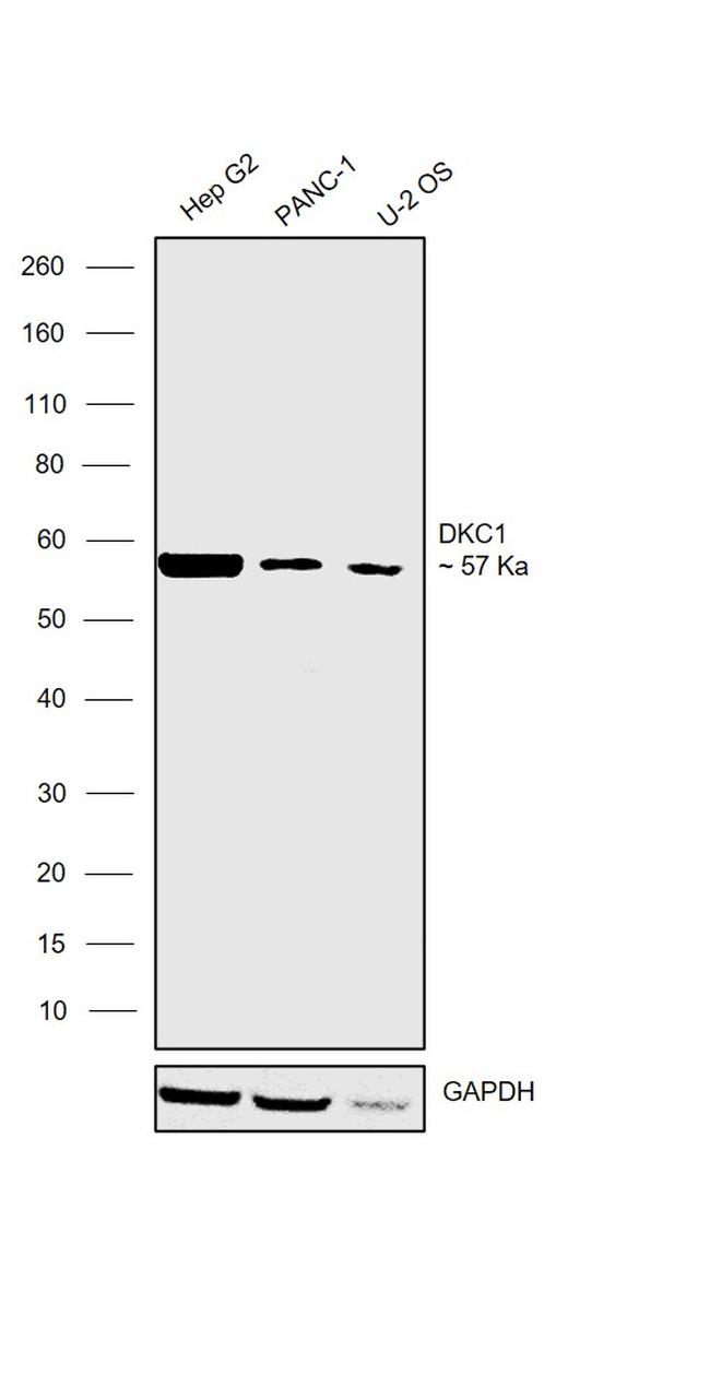 DKC1 Antibody in Western Blot (WB)