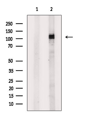 TNK2 Antibody in Western Blot (WB)