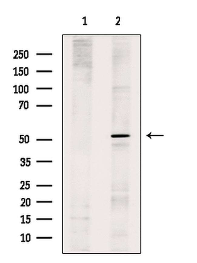 GLRA1 Antibody in Western Blot (WB)