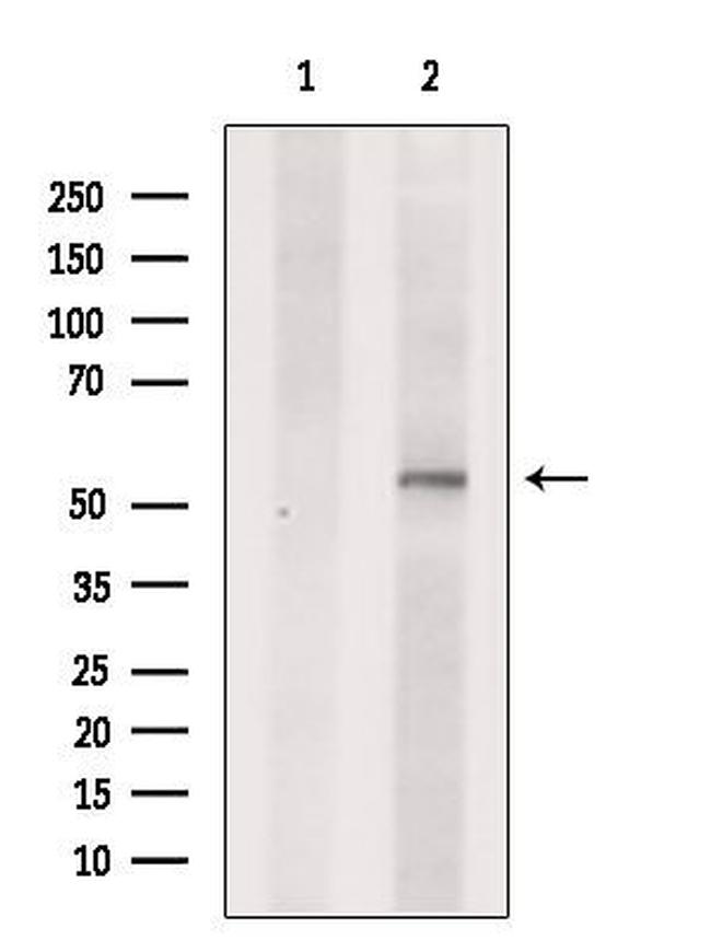 SLC16A4 Antibody in Western Blot (WB)
