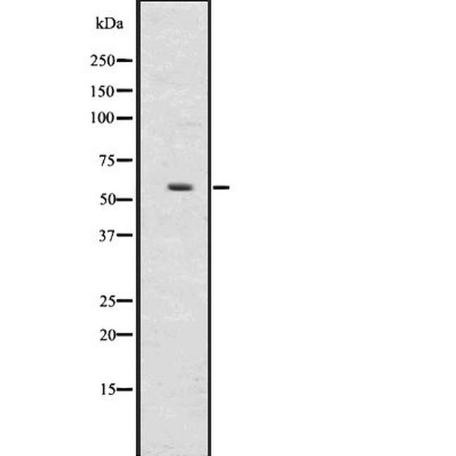 UGT2B17 Antibody in Western Blot (WB)