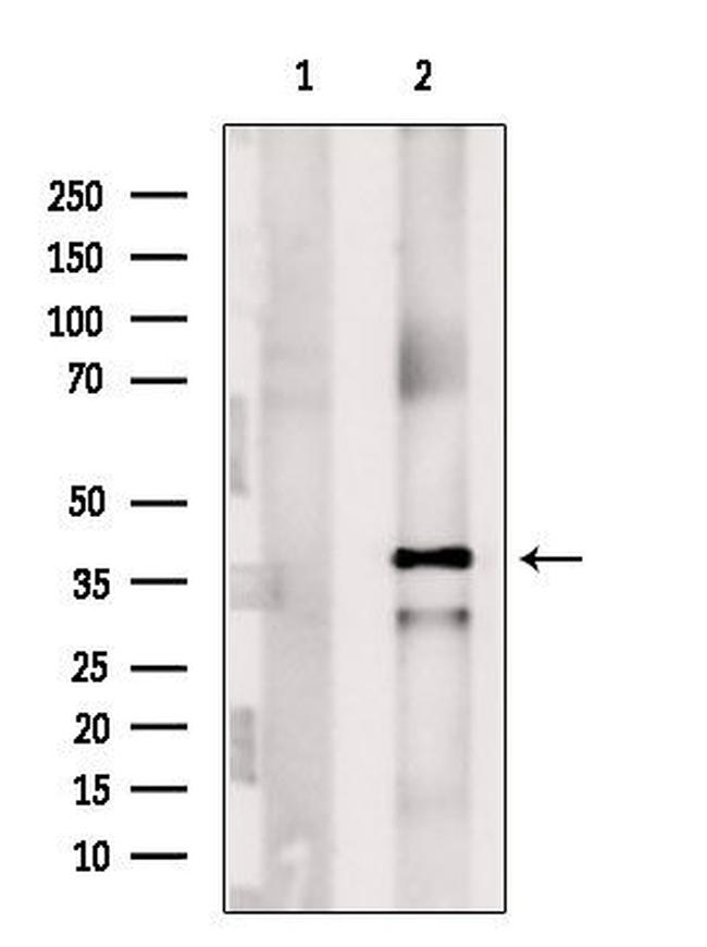 NDUFAF1 Antibody in Western Blot (WB)