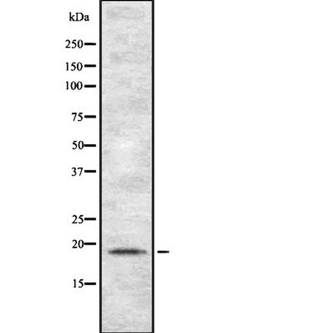 TSPO Antibody in Western Blot (WB)
